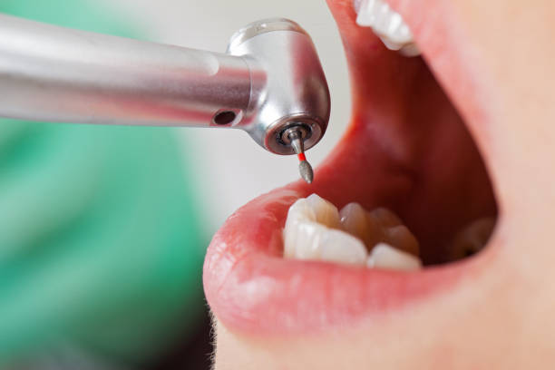 Best Knocked-Out Tooth Emergency  in Chewelah, WA